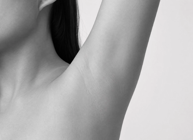 hiperidrosis