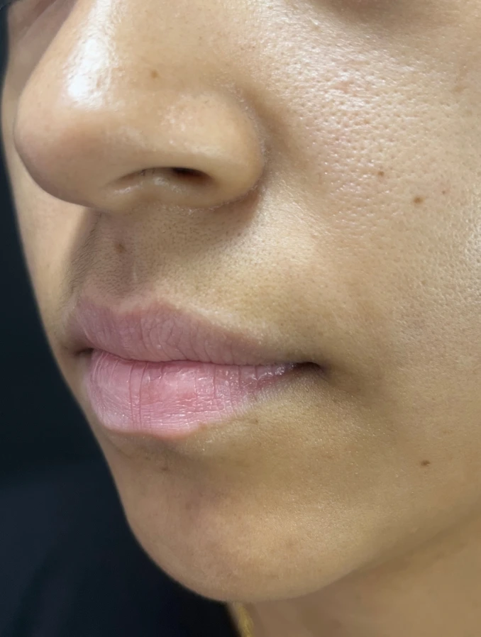Armonización labial - Antes